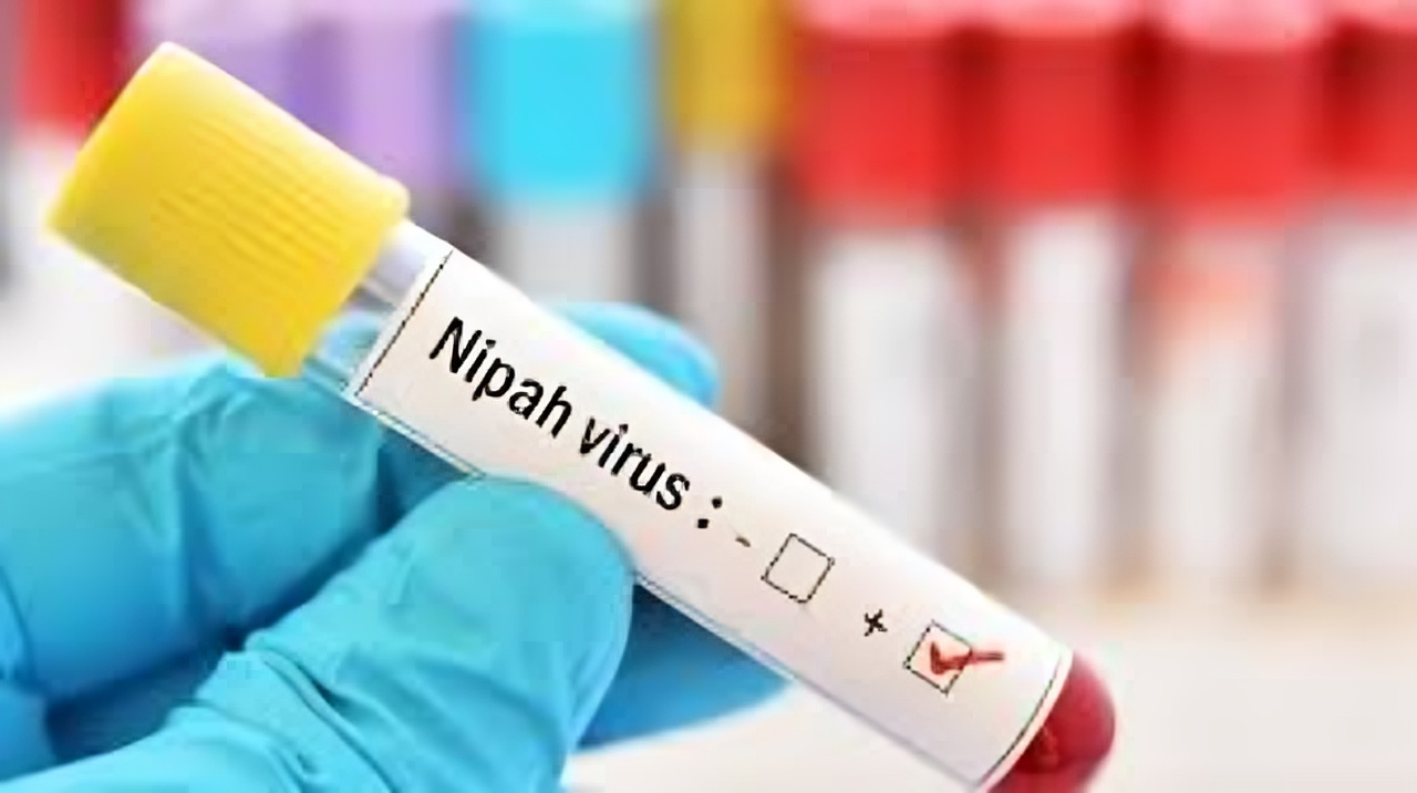 Rajasthan Issues Nipah Virus Alert After Fatal Case in Kerala